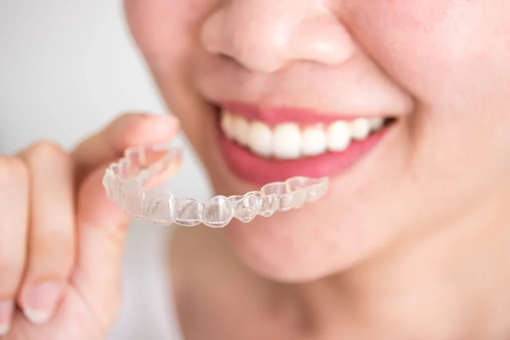 What Should You Know About Clear Aligners? 2 clear aligner in Dubai