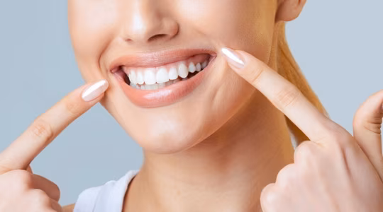 Teeth Whitening in Dubai 1