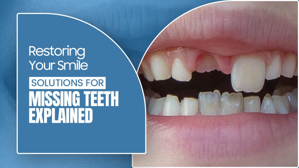 Top 12 Teeth Problems and Solutions 7 Missing teeth